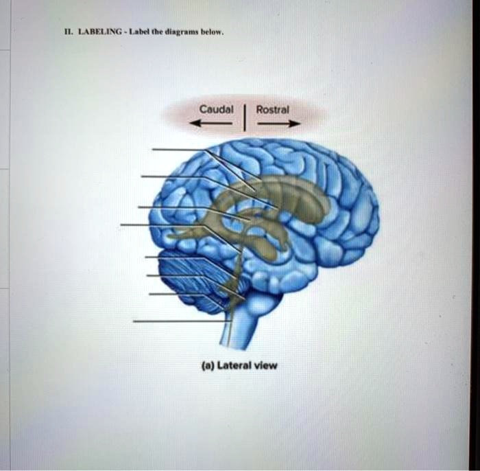 SOLVED: ILLABELING - Label the diagrams below Caudal Rostral (a ...