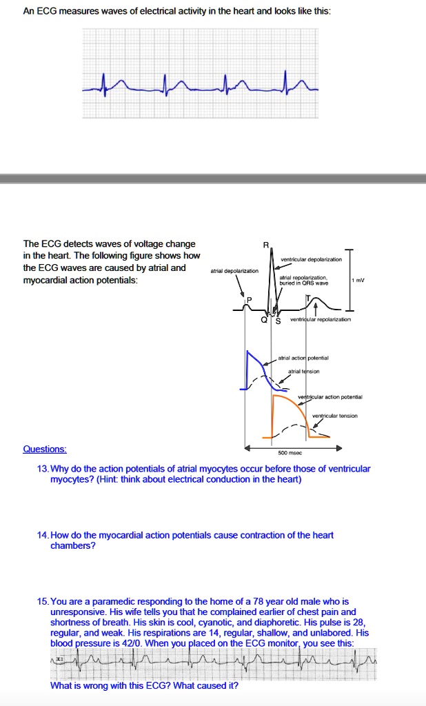 SOLVED: An ECG measures waves of electrical activity in the heart and ...