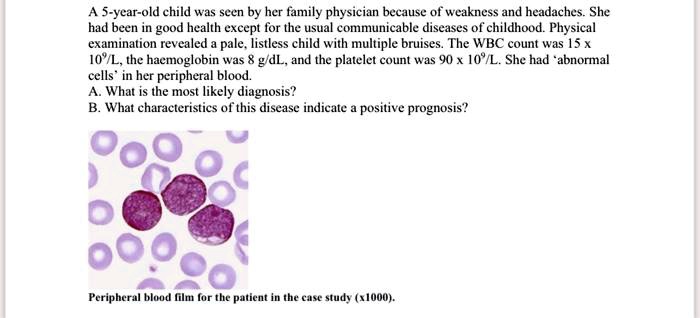 A 5-year-old child was seen by her family physician because of weakness and headaches. She had been in good health except for the usual communicable diseases of childhood. Physical examination revealed a pale, listless child with multiple bruises. The WBC count was 15 x 10?/L, the haemoglobin was 8 g/dL, and the platelet count was 90 x 10?/L. She had ‘abnormal cells’ in her peripheral blood.
A. What is the most likely diagnosis?
B. What characteristics of this disease indicate a positive prognosis?
Peripheral blood film for the patient in the case study (x1000).