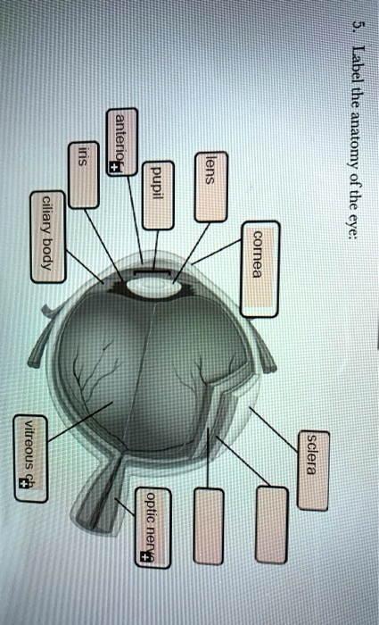 5. Label the anatomy of the eye:
cornea
lens
pupil
anterior
iris
ciliary body
vitreous ch
optic nerve
sclera