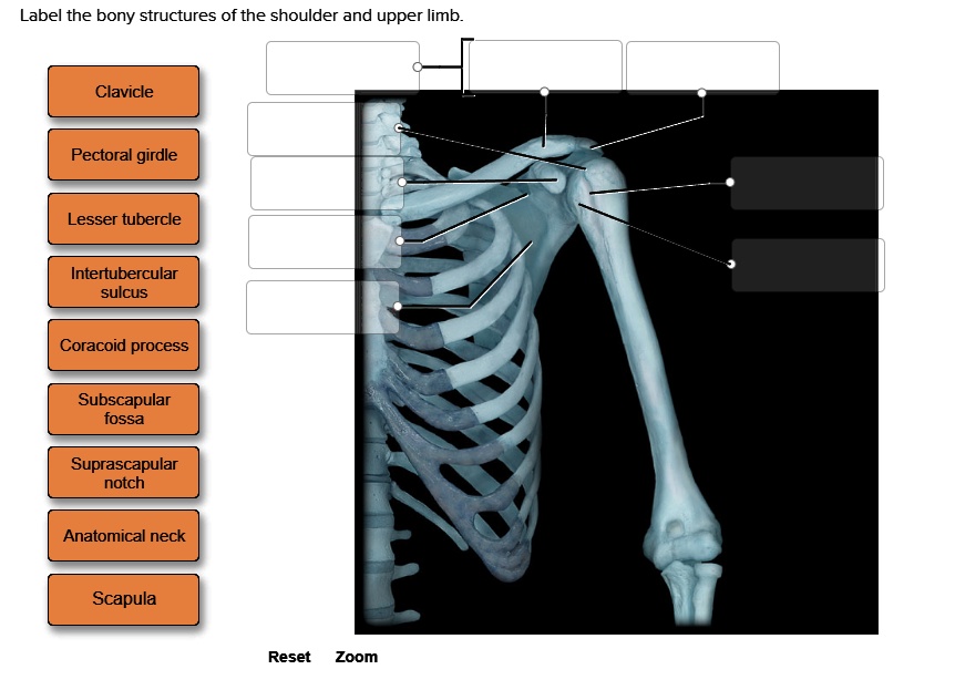 SOLVED: Label the bony structures of the shoulder and upper limb. Label