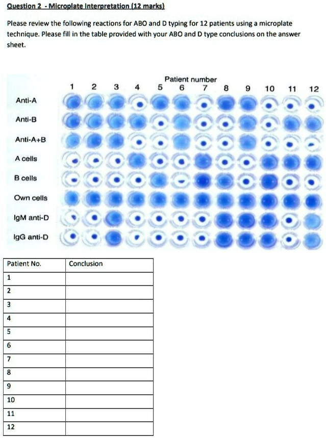 SOLVED Please review the following reactions for ABO and D typing for 12 patients using the