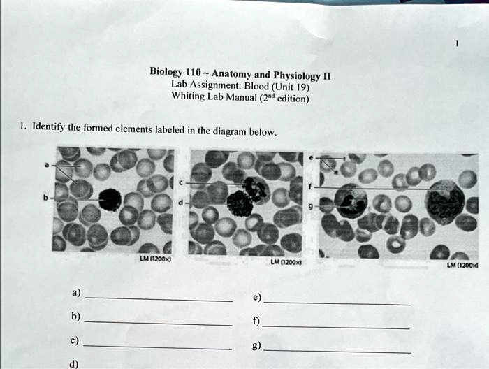 SOLVED Biology 110 Anatomy and Physiology II Lab Assignment Blood