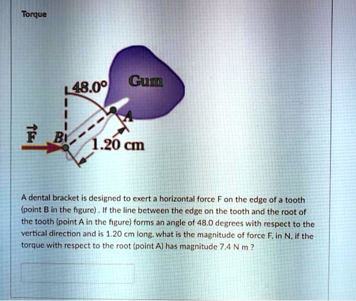 SOLVEDTorque 48.09 Gum F Bt 20 cm A dental bracket is designed to