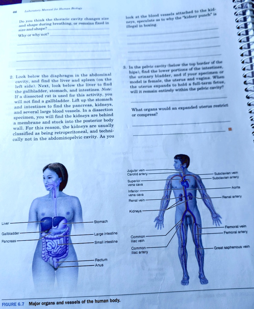 66
Laboratory Manual for Human Biology
Do you think the thoracic cavity changes size
and shape during breathing, or remains fixed in
size and shape?
Why or why not?
look at the blood vessels attached to the kid-
neys, speculate as to why the "kidney punch" is
illegal in boxing.
2. Look below the diaphragm in the abdominal
cavity, and find the liver and spleen (on the
left side). Next, look below the liver to find
the gallbladder, stomach, and intestines. Note:
If a dissected rat is used for this activity, you
will not find a gallbladder. Lift up the stomach
and intestines to find the pancreas, kidneys,
and several large blood vessels. In a dissection
specimen, you will find the kidneys are behind
a membrane and stuck into the posterior body
wall. For this reason, the kidneys are usually
classified as being retroperitoneal, and techni-
cally not in the abdominopelvic cavity. As you
3. In the pelvic cavity (below the top border of the
hips), find the lower portions of the intestines,
the urinary bladder, and if your specimen or
model is female, the uterus and vagina. When
the uterus expands to hold a full-term fetus,
will it remain entirely within the pelvic cavity?
What organs would an expanded uterus restrict
or compress?
Liver
Gallbladder
Pancreas
Jugular vein
Carotid artery
Superior
vena cava
Inferior
vena cava
Renal vein
Subclavian vein
Subclavian artery
Aorta
Renal artery
Kidneys
Stomach
Large intestine
Small intestine
Rectum
Anus
FIGURE 6.7 Major organs and vessels of the human body.
Common
iliac vein
Common
iliac artery
Femoral vein
Femoral artery
Great saphenous vein