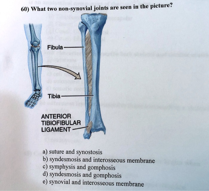 Solved: What Two Non-synovial Joints Are Seen In The Picture? Fibula 