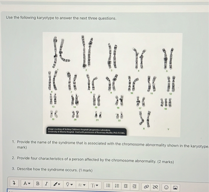 SOLVED: Use the following karyotype to answer the next three questions ...