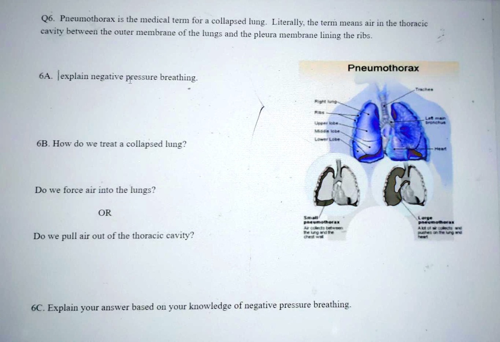 solved-q6-pneumothorax-is-the-medical-term-for-a-collapsed-lung