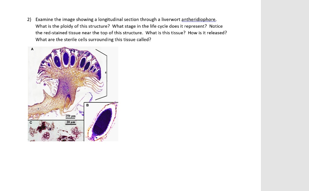 solved-examine-the-image-showing-a-longitudinal-section-through-a