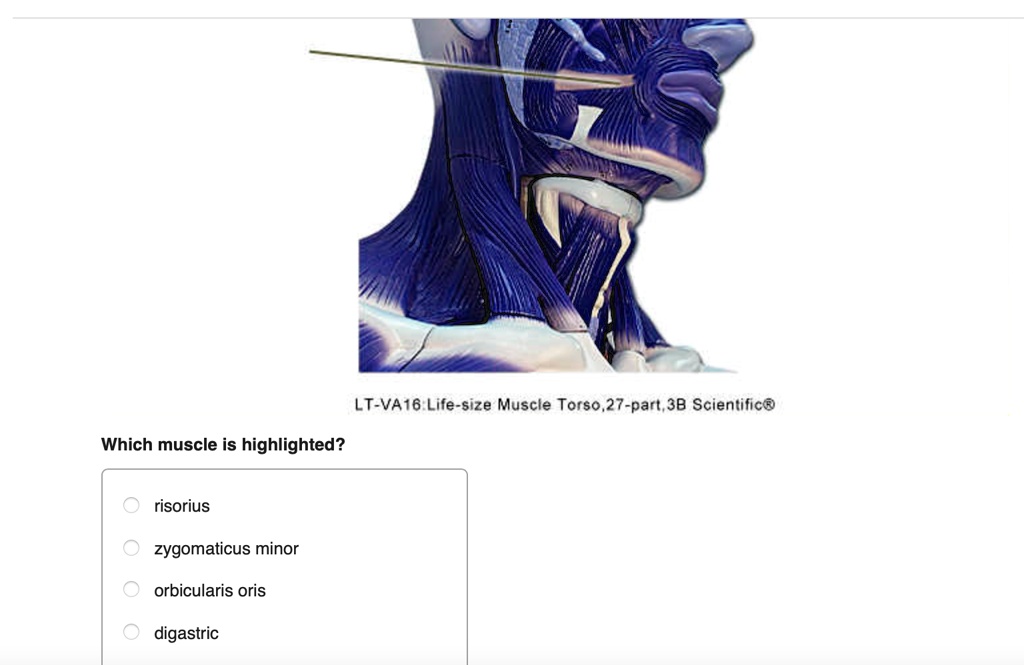 SOLVED Which muscle is highlighted risorius zygomaticus minor