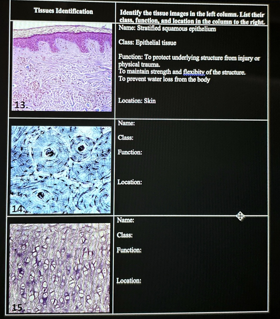 [GET ANSWER] tissues identification identify the tissue images in the ...
