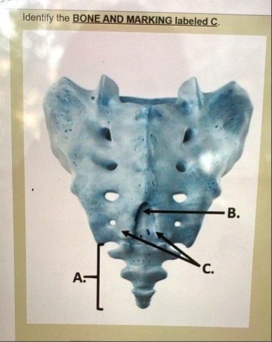 identify the bone and marking labeled c identify the bone and marking labeled c a b c 66104