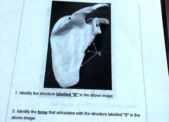 Identify The Structure Labelled "B"in The Above Image: 2. Identify The ...