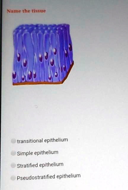 Name the tissue
transitional epithelium
Simple epithelium
Stratified epithelium
Pseudostratified epithelium