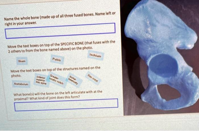 Bone Text Box Name the whole bone (made up of all three fused bones. Name left or ...
