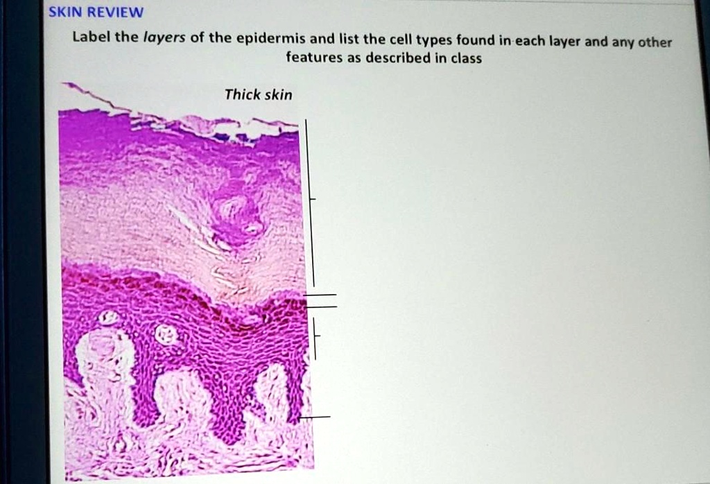 case study developing thick skin answers