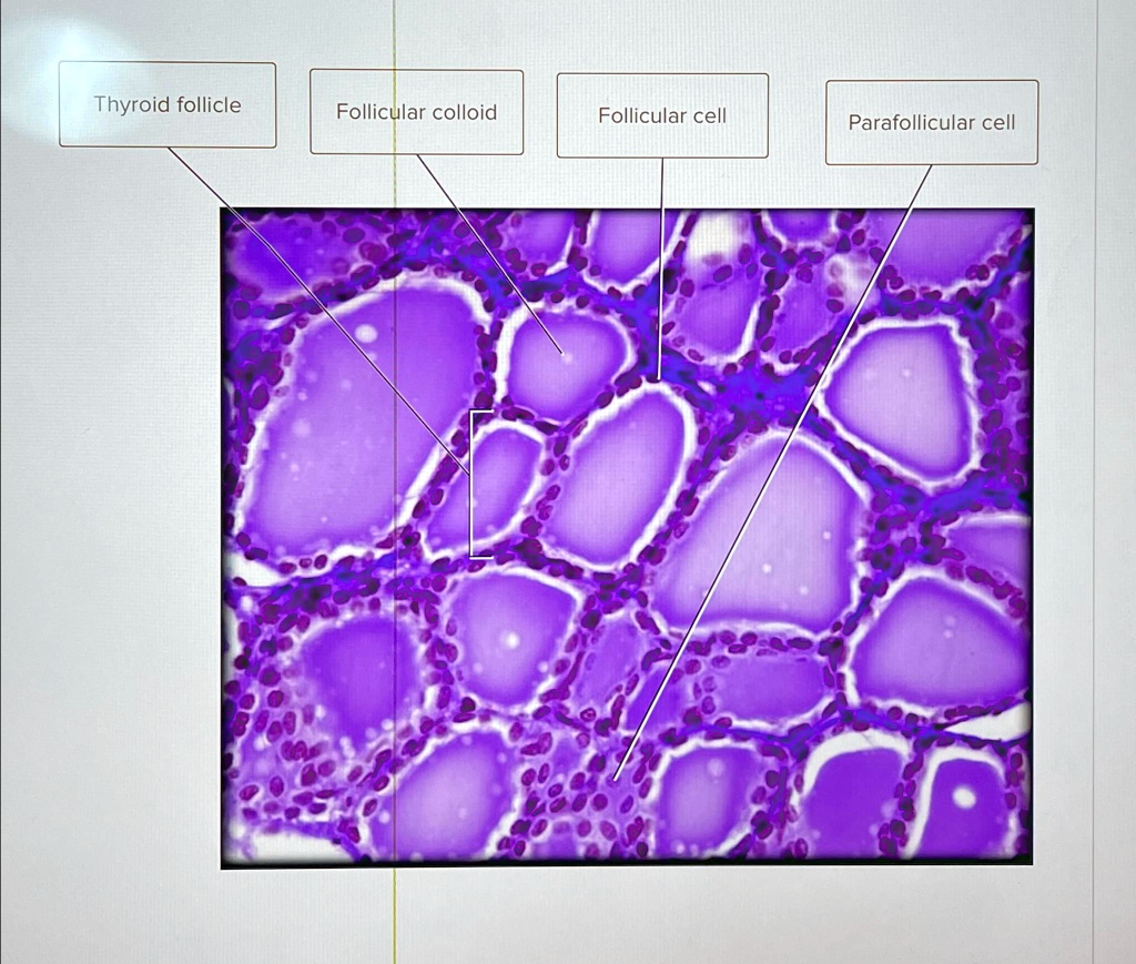 Solved Identifying Thyroid Gland Histology Thyroid Follicle Follicular