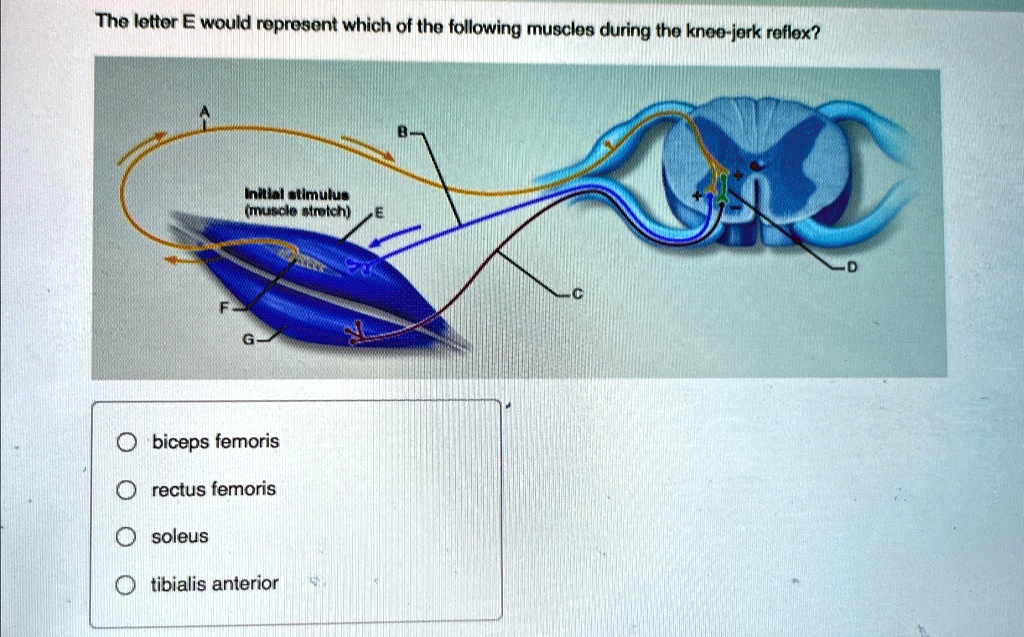 The letter E would represent which of the following muscles...