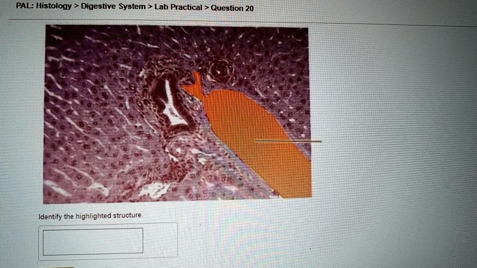 SOLVED PAL Histology > Digestive System Lab Practical Question 20