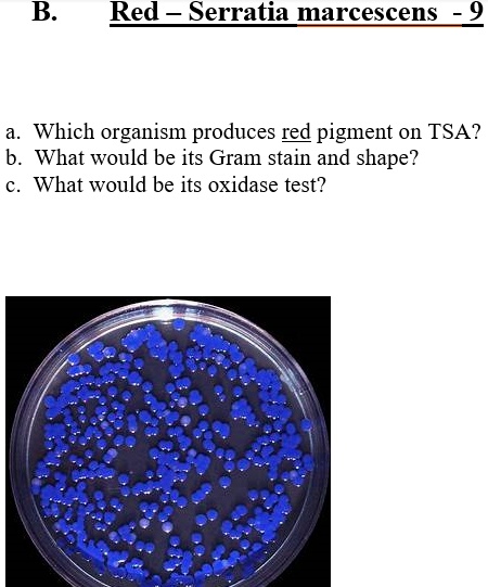 serratia marcescens oxidase test