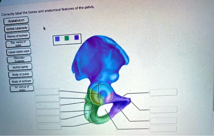 Correctly label the bones and anatomical features of the pelvis.
Acetabulum
Ischial tuberosity
Ramus of ischium
Sup. ramus of pubis
Lesser sciatic notch
Obturator foramen
Ischial spine
Body of pubis
Body of ischium
Inf. ramus of pubis