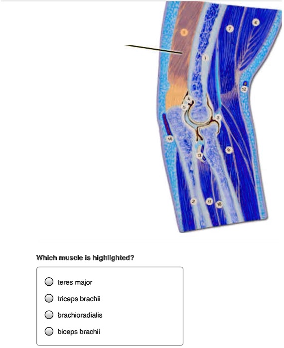 Which muscle is highlighted?

teres major
triceps brachii
brachioradialis
biceps brachii