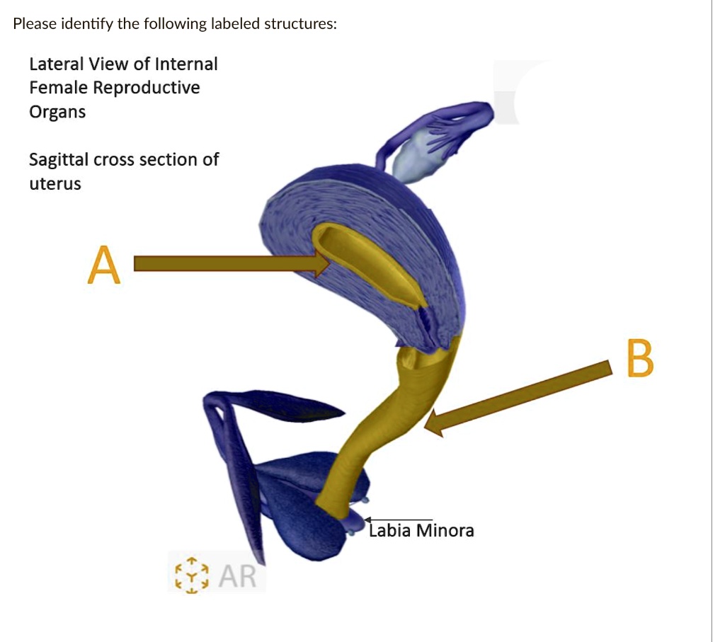 SOLVED: Please Identify The Following Labeled Structures ...