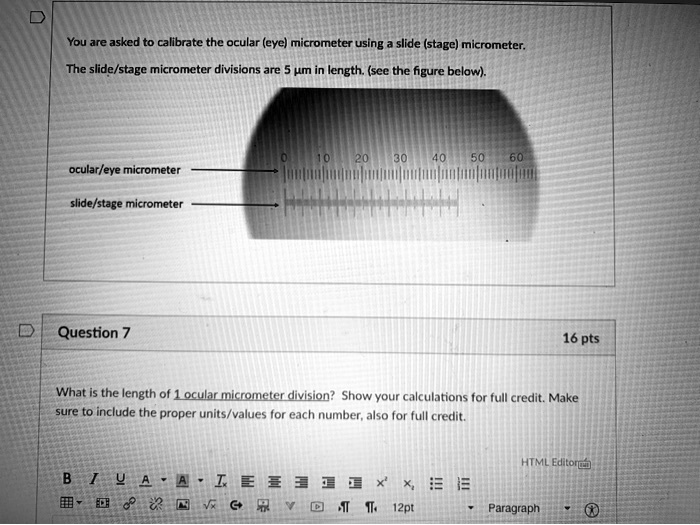 You are asked to calibrate the ocular (eye) micrometer using a slide