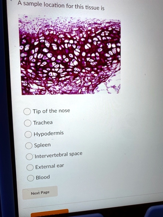 A sample location for this tissue is: - Tip of the nose - Trachea ...