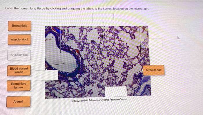 SOLVED: Label the human lung tissue by clicking and dragging the labels ...