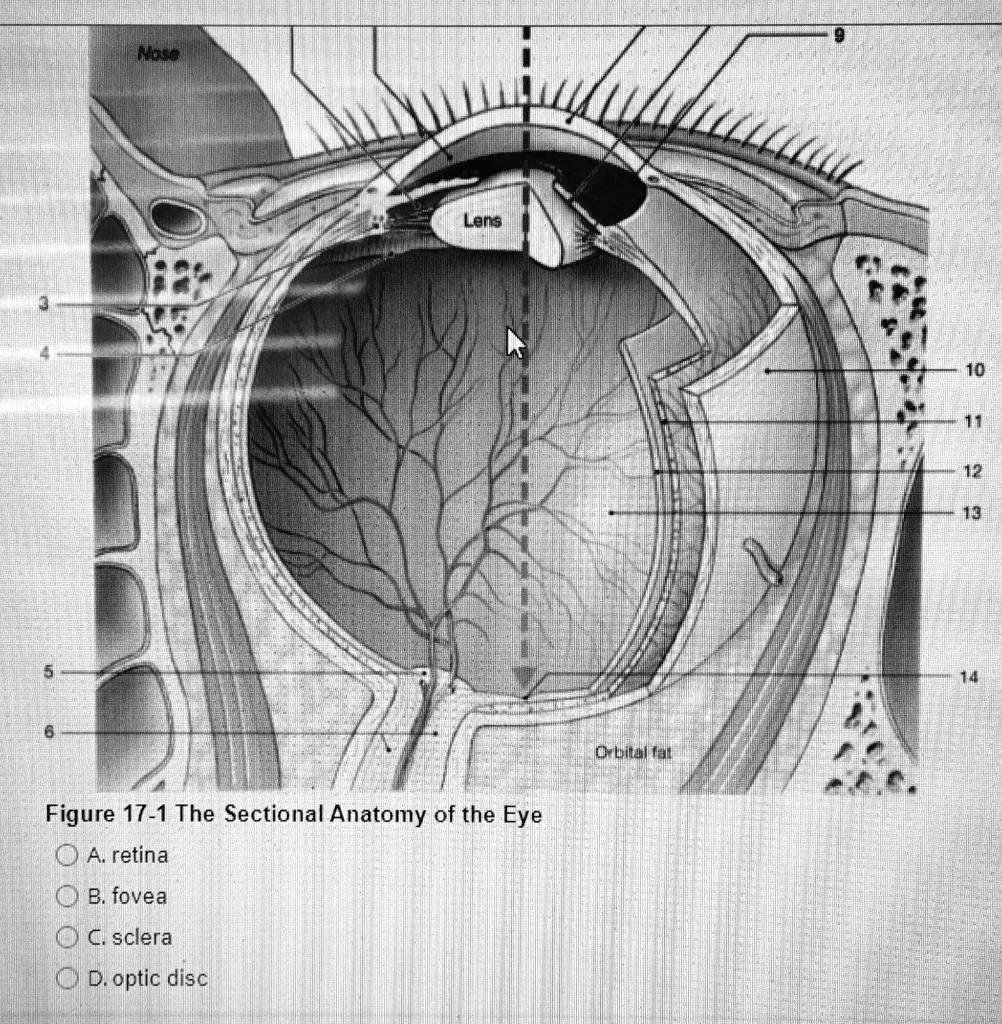 5 6 Nose Lens Figure 17-1 The Sectional Anatomy of the Eye A. retina B ...