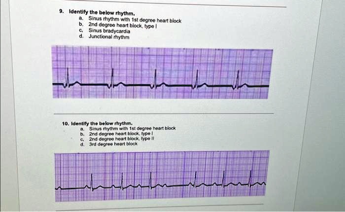 9 identify the below rhythm a sinus rhythm with 1st degree heart block b 2nd degree heart block type l c sinus bradycardia d junctional rhythm 10 identify the below rhythm b 2nd degree heart 17232