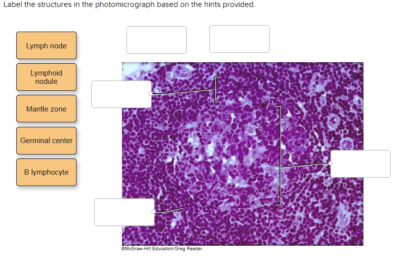 Label the structures in the photomicrograph based on the hints provided ...
