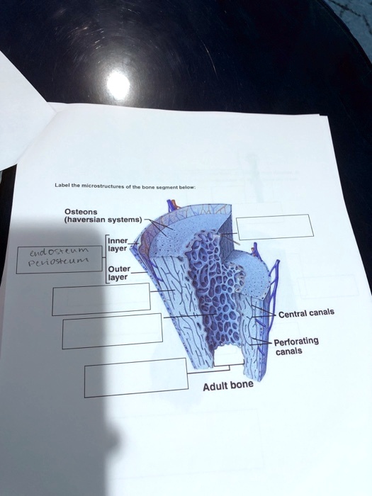 Label the microstructures of the bone segment below:
Osteons
(haversian systems)
Inner
layer
Outer
layer
endosteum
Periosteum
Adult bone
Central canals
Perforating
canals