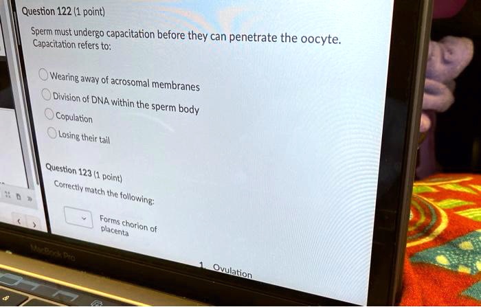 Question 122 (1 point)
Sperm must undergo capacitation before they can penetrate the oocyte.
Capacitation refers to:
Wearing away of acrosomal membranes
Division of DNA within the sperm body
Copulation
Losing their tail
Question 123 (1 point)
Correctly match the following:
Forms chorion of
placenta
1. Ovulation