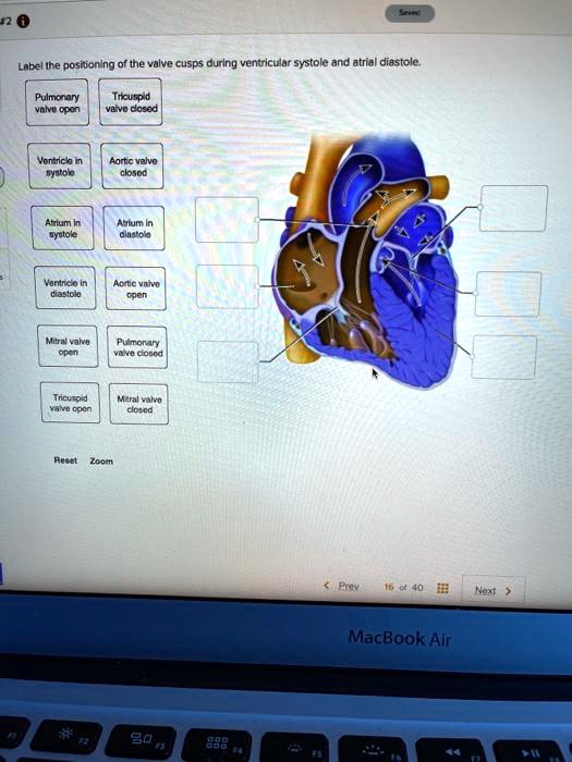 SOLVED Label the positioning of the valve cusps during ventricular