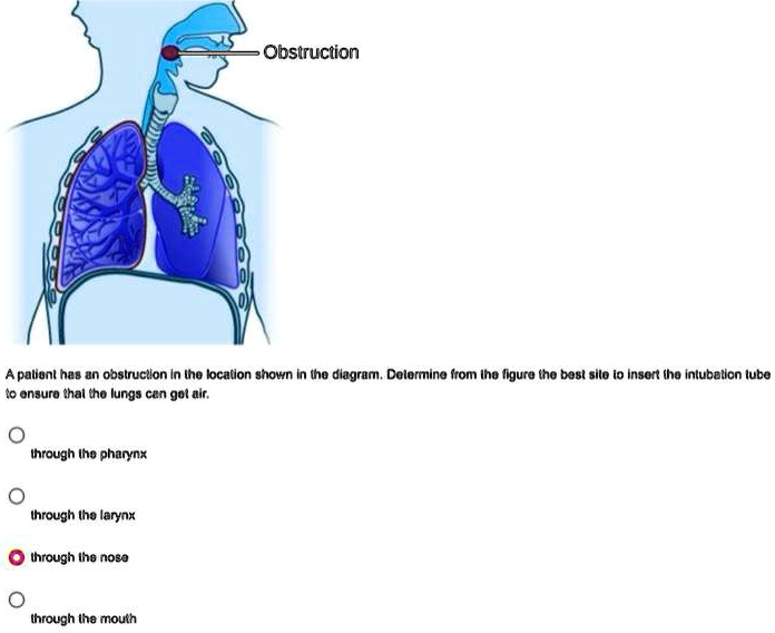 SOLVED: A patient has an obstruction in the location shown in the ...