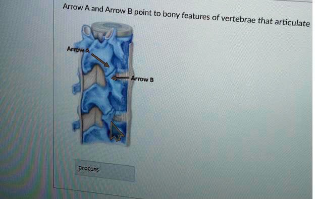 arrow a and arrow b point to bony features of vertebrae that articulate ...