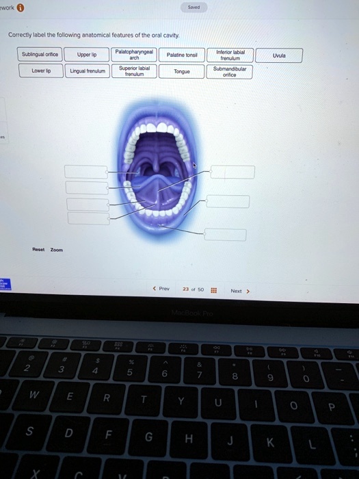 SOLVED Correctly label the following anatomical features of the oral