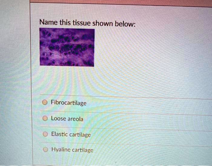 Solved: Name This Tissue Shown Below Fibrocartilage Loose Areola 