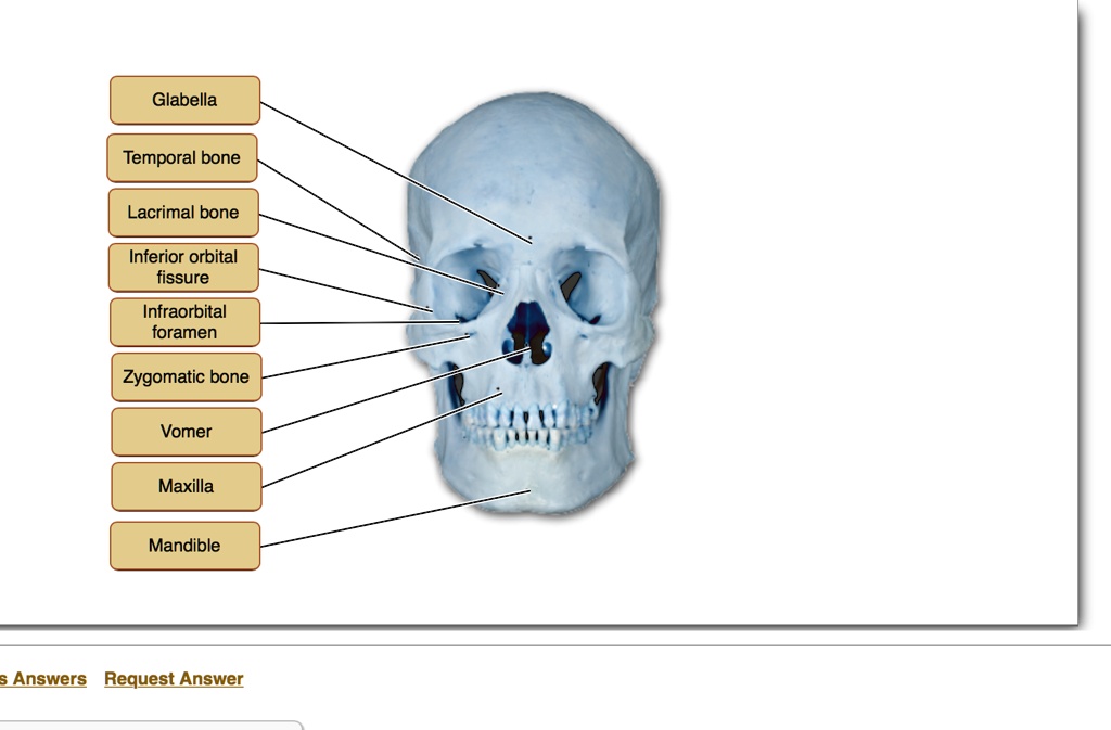 Glabella
Temporal bone
Lacrimal bone
Inferior orbital
fissure
Infraorbital
foramen
Zygomatic bone
Vomer
Maxilla
Mandible