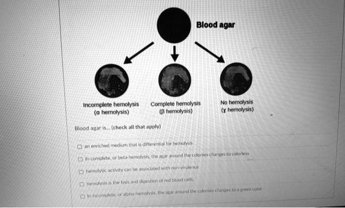 Blood agar
Incomplete hemolysis
(? hemolysis)
Complete hemolysis
(? hemolysis)
No hemolysis
(? hemolysis)
Blood agar is... (check all that apply)
an enriched medium that is differential for hemolysis
In complete, or beta-hemolysis, the agar around the colonies changes to colorless
hemolytic activity can be associated with non-virulence
hemolysis is the lysis and digestion of red blood cells.
In incomplete, or alpha-hemolysis, the agar around the colonies changes to a green color