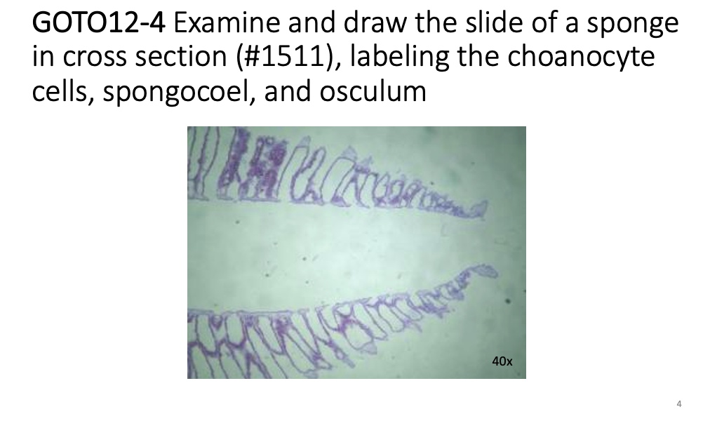 SOLVED GOTO124 Examine and draw the slide of a sponge in cross