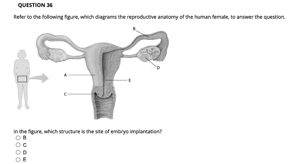 Solved Question 36 Refer To The Following Figure Which Diagrams The