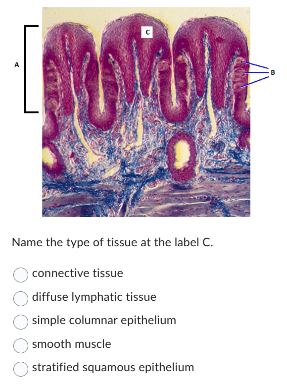 SOLVED: Name the type of tissue at the label C. connective tissue ...