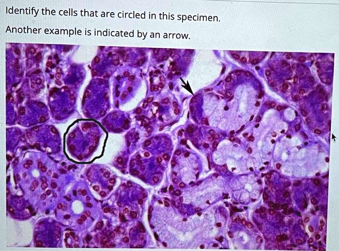 Identify the cells that are circled in this specimen.
Another example is indicated by an arrow.