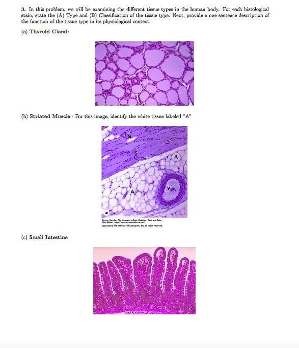 3. In this problem, we will be examining the different tissue types in ...