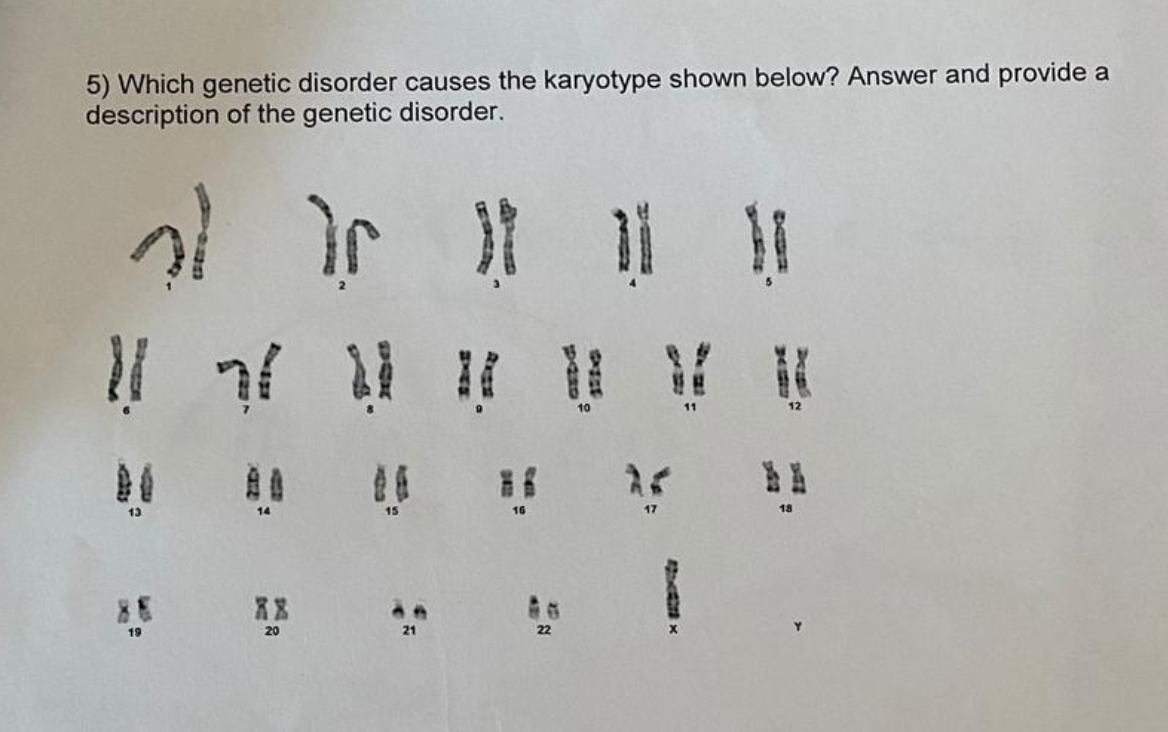 SOLVED: 5) Which genetic disorder causes the karyotype shown below ...