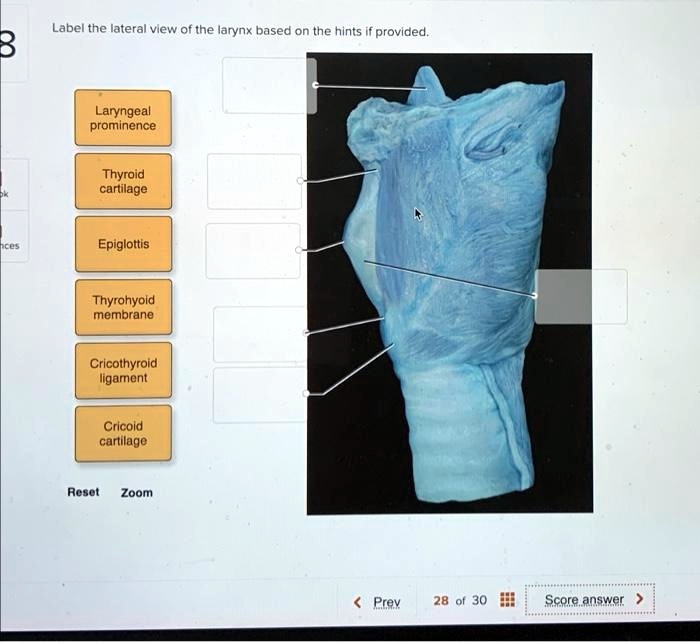 SOLVED: Label Label the lateral view of the larynx based on the hints ...