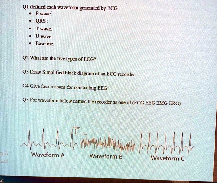 SOLVED: Q1 defined each waveform generated by ECG: P wave: QRS complex ...